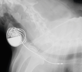 Pacemaker x-ray Pacemaker x-ray